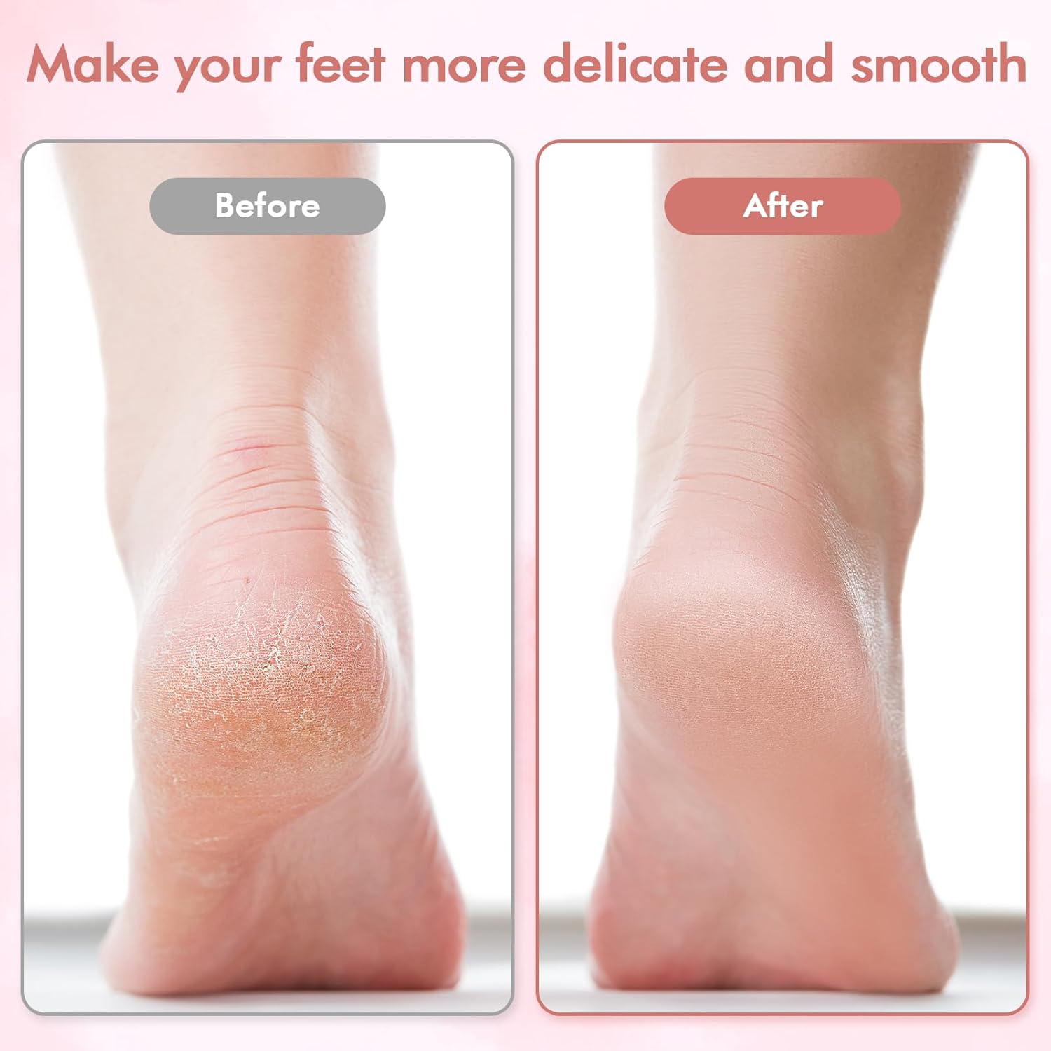 Portable Electronic Foot File Pedicure Tools,