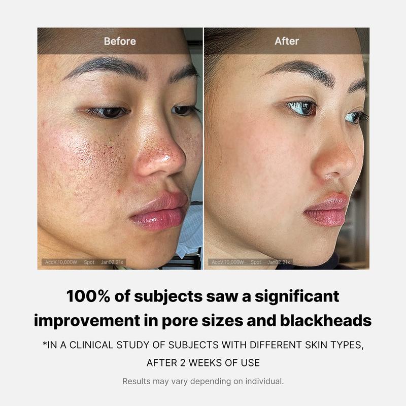 [medicube Official] Zero Pore Pads (AHA + BHA) | Korean No.1 Toner Pads