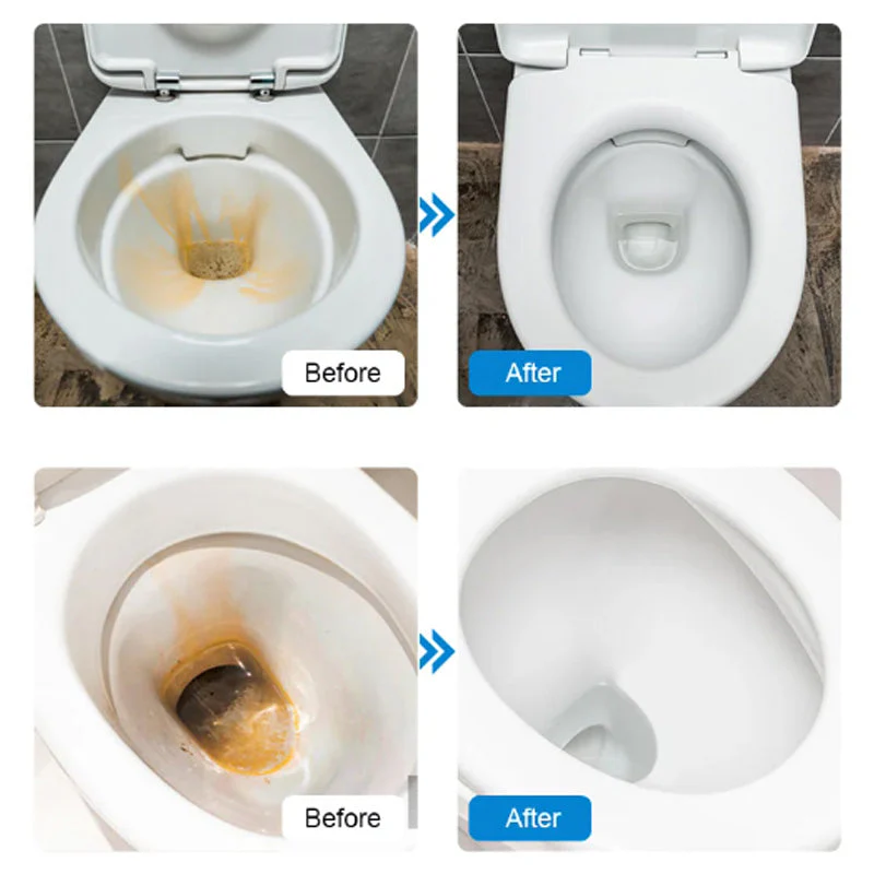 👉Powerful Toilet Bowl Cleaner Tablets💥Get 50% to 70% off for a limited time!