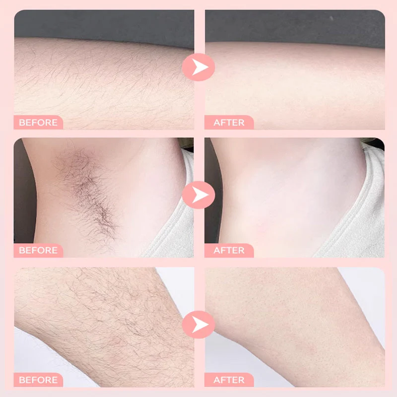 🎉Summer Hot Sale🎉Convenient Gentle Hair Removal Cream